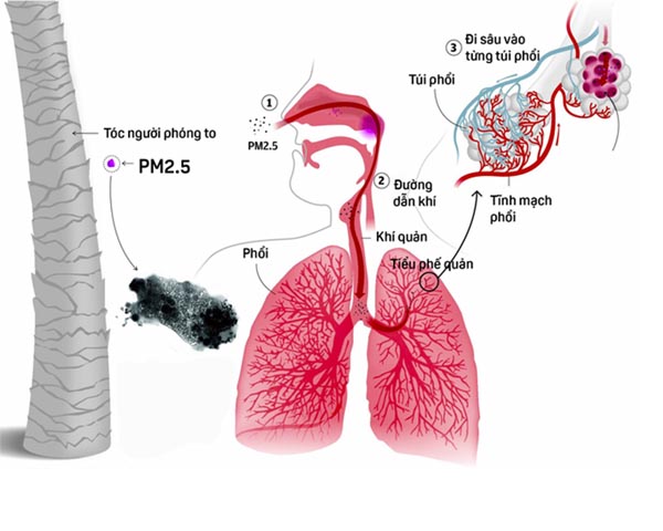 Nguyên nhân gây ra bụi mịn pm 1.0, pm 2.5, pm 10