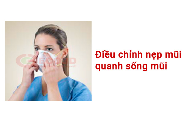 Điều chỉnh nẹp mũi xung quanh sống mũi