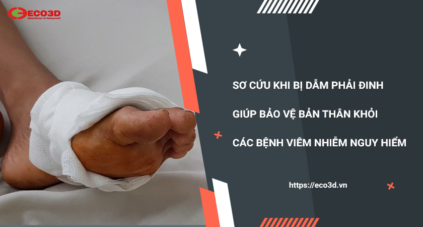 sơ cứu khi dẫm đinh