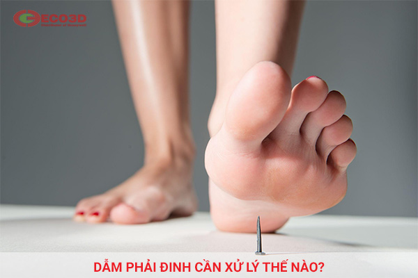 Dẫm phải đinh cần xử lý thế nào?